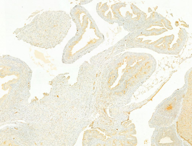 FAP Antibody in Immunohistochemistry (Paraffin) (IHC (P))