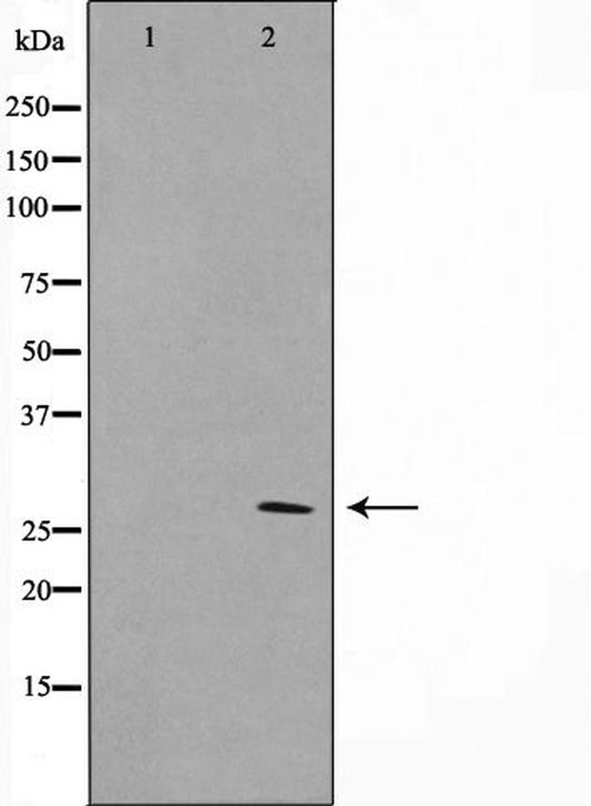 KDELR3 Antibody in Western Blot (WB)