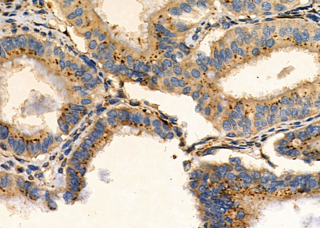 GABRG1 Antibody in Immunohistochemistry (Paraffin) (IHC (P))