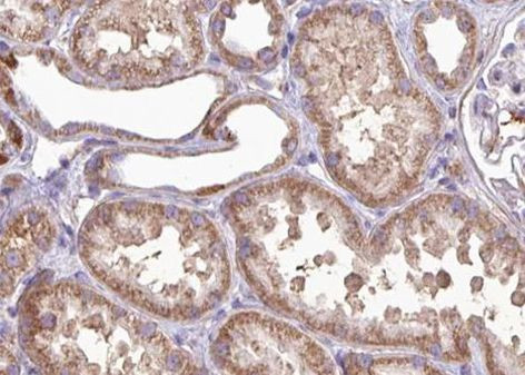 MRRF Antibody in Immunohistochemistry (Paraffin) (IHC (P))