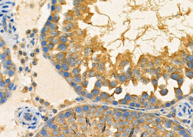 MRRF Antibody in Immunohistochemistry (Paraffin) (IHC (P))