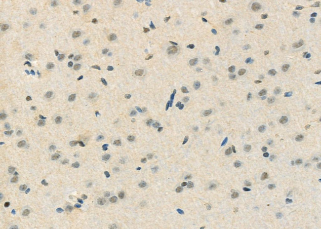 CtBP1 Antibody in Immunohistochemistry (Paraffin) (IHC (P))