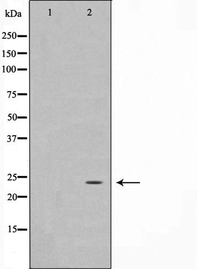 PPP1R2 Antibody in Western Blot (WB)