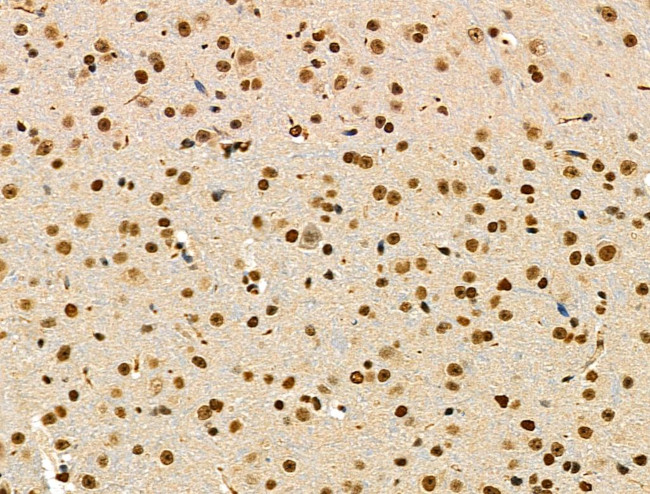 Phospho-CtBP1 (Ser422) Antibody in Immunohistochemistry (Paraffin) (IHC (P))