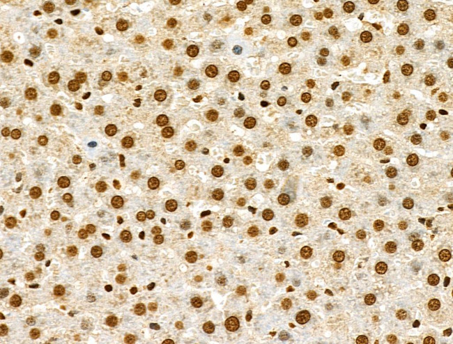 Phospho-CtBP1 (Ser422) Antibody in Immunohistochemistry (Paraffin) (IHC (P))