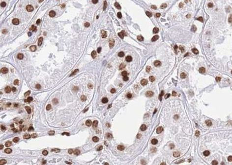 Phospho-CtBP1 (Ser422) Antibody in Immunohistochemistry (Paraffin) (IHC (P))