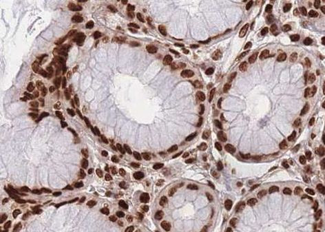 MEKK4 Antibody in Immunohistochemistry (Paraffin) (IHC (P))