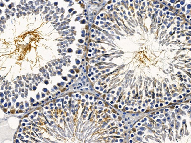 SUPT16H Antibody in Immunohistochemistry (Paraffin) (IHC (P))