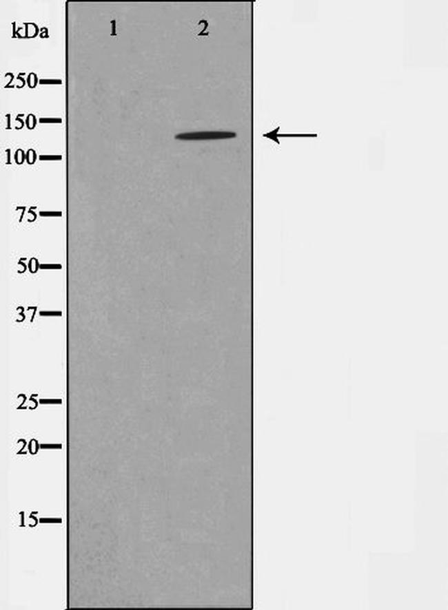 Phospho-NMDAR1 (Ser897) Antibody in Western Blot (WB)