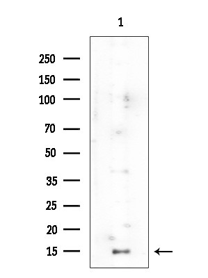 H3K23ac Antibody in Western Blot (WB)