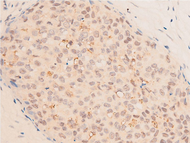 Acetyl-p53 (Lys319) Antibody in Immunohistochemistry (Paraffin) (IHC (P))