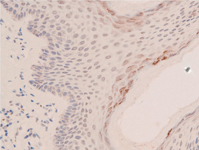 Acetyl-p53 (Lys319) Antibody in Immunohistochemistry (Paraffin) (IHC (P))