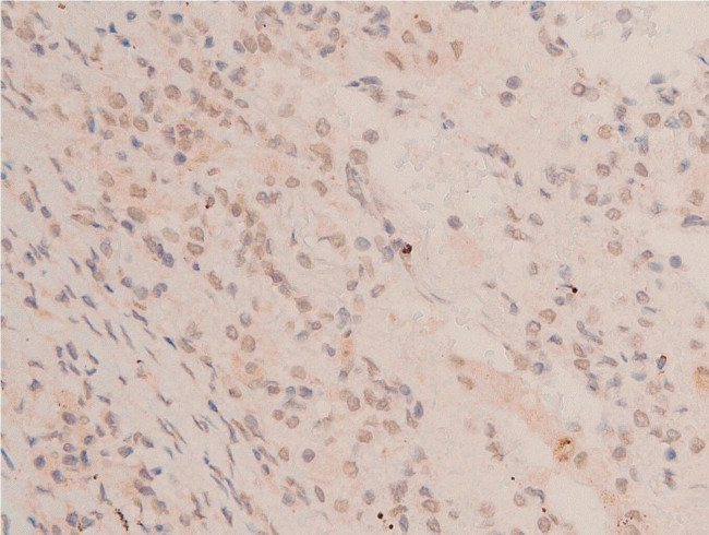 Acetyl-p53 (Lys319) Antibody in Immunohistochemistry (Paraffin) (IHC (P))