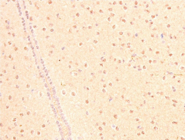 Acetyl-p53 (Lys319) Antibody in Immunohistochemistry (Paraffin) (IHC (P))