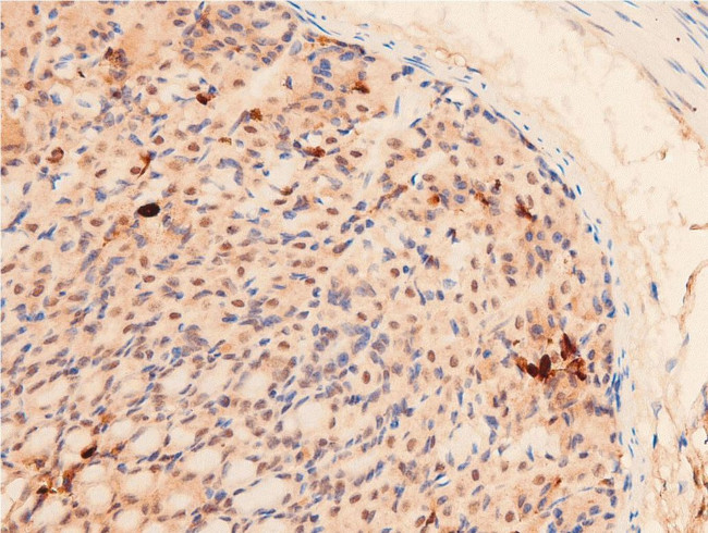 Acetyl-p53 (Lys319) Antibody in Immunohistochemistry (Paraffin) (IHC (P))