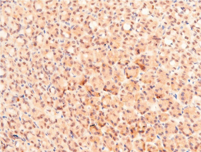 Acetyl-p53 (Lys319) Antibody in Immunohistochemistry (Paraffin) (IHC (P))