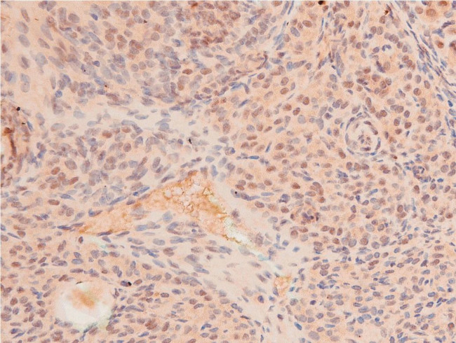 Acetyl-p53 (Lys319) Antibody in Immunohistochemistry (Paraffin) (IHC (P))