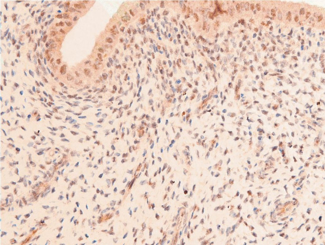 Acetyl-p53 (Lys319) Antibody in Immunohistochemistry (Paraffin) (IHC (P))