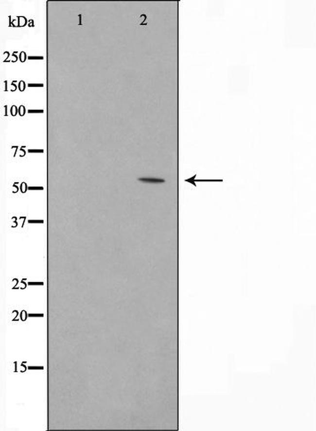 Acetyl-p53 (Lys319) Antibody in Western Blot (WB)
