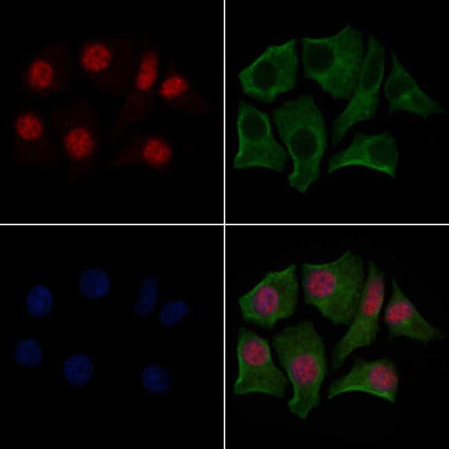 Phospho-Glucocorticoid Receptor (Ser211) Antibody in Immunocytochemistry (ICC/IF)