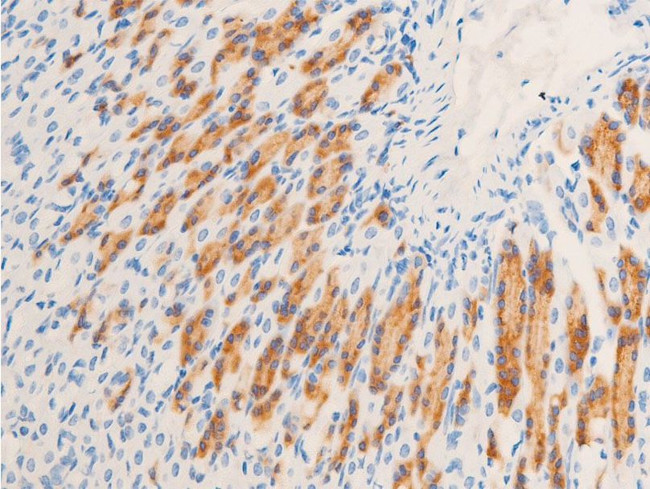 Phospho-Glucocorticoid Receptor (Ser211) Antibody in Immunohistochemistry (Paraffin) (IHC (P))