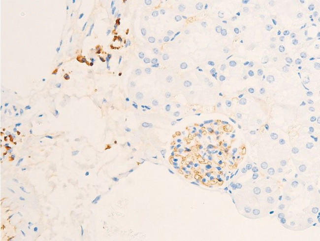 Phospho-Glucocorticoid Receptor (Ser211) Antibody in Immunohistochemistry (Paraffin) (IHC (P))