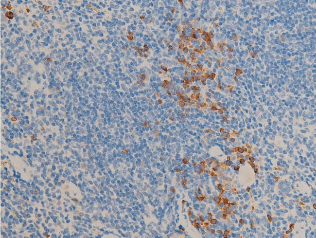 Phospho-Glucocorticoid Receptor (Ser211) Antibody in Immunohistochemistry (Paraffin) (IHC (P))