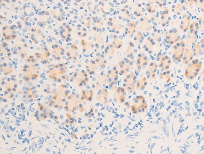 Phospho-Glucocorticoid Receptor (Ser211) Antibody in Immunohistochemistry (Paraffin) (IHC (P))