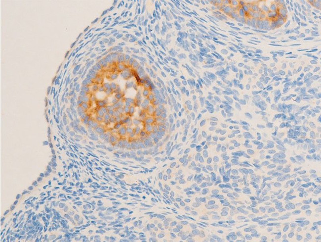 Phospho-Glucocorticoid Receptor (Ser211) Antibody in Immunohistochemistry (Paraffin) (IHC (P))