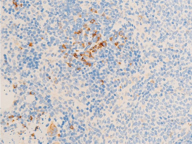 Phospho-Glucocorticoid Receptor (Ser211) Antibody in Immunohistochemistry (Paraffin) (IHC (P))