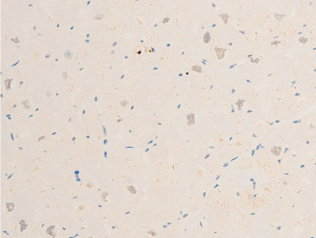 Phospho-SYK (Tyr323) Antibody in Immunohistochemistry (Paraffin) (IHC (P))