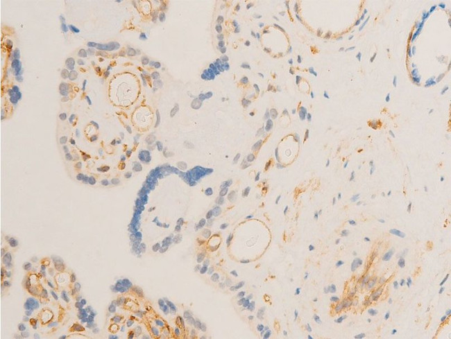 Phospho-SYK (Tyr323) Antibody in Immunohistochemistry (Paraffin) (IHC (P))