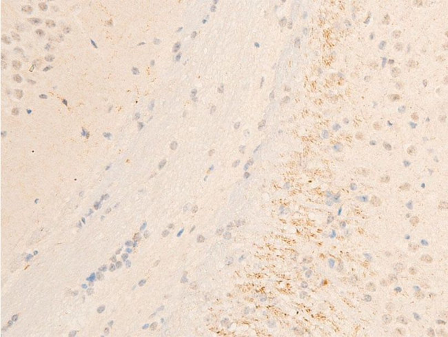 Phospho-SYK (Tyr323) Antibody in Immunohistochemistry (Paraffin) (IHC (P))