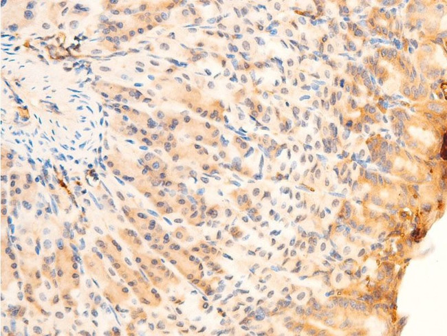 Phospho-SYK (Tyr323) Antibody in Immunohistochemistry (Paraffin) (IHC (P))