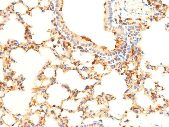 Phospho-SYK (Tyr323) Antibody in Immunohistochemistry (Paraffin) (IHC (P))