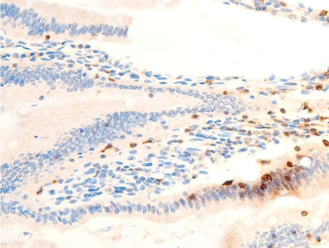 Phospho-SYK (Tyr323) Antibody in Immunohistochemistry (Paraffin) (IHC (P))