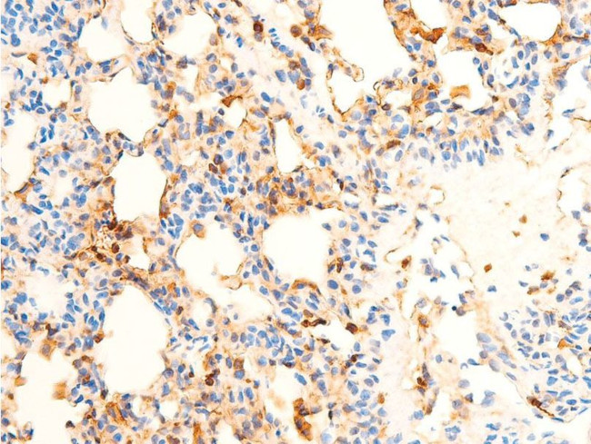 Phospho-SYK (Tyr323) Antibody in Immunohistochemistry (Paraffin) (IHC (P))