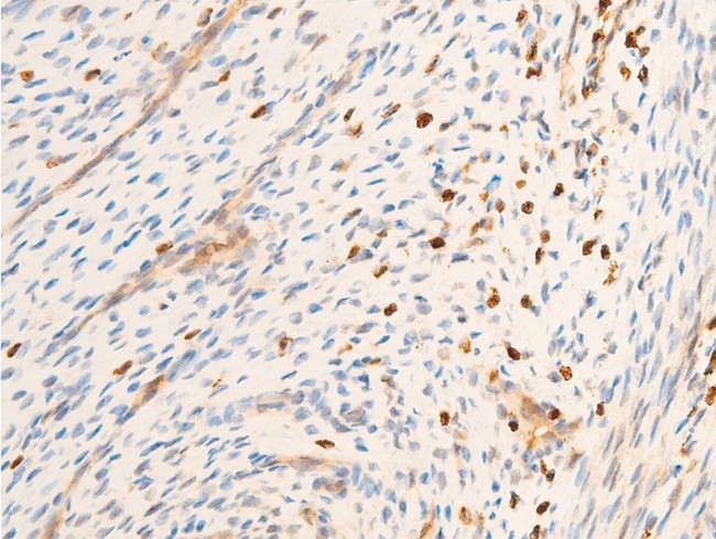 Phospho-SYK (Tyr323) Antibody in Immunohistochemistry (Paraffin) (IHC (P))