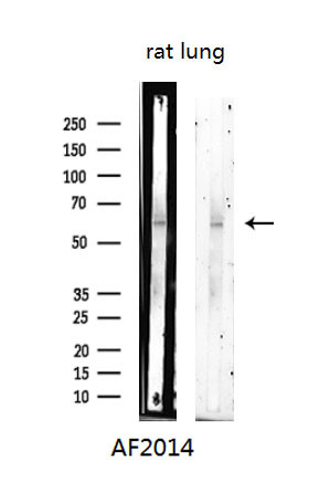 Phospho-Chk1 (Ser280) Antibody in Western Blot (WB)