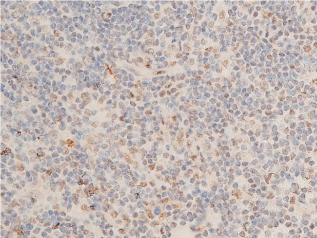 Phospho-Chk1 (Ser280) Antibody in Immunohistochemistry (Paraffin) (IHC (P))