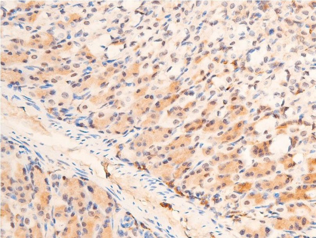 Phospho-Chk1 (Ser280) Antibody in Immunohistochemistry (Paraffin) (IHC (P))