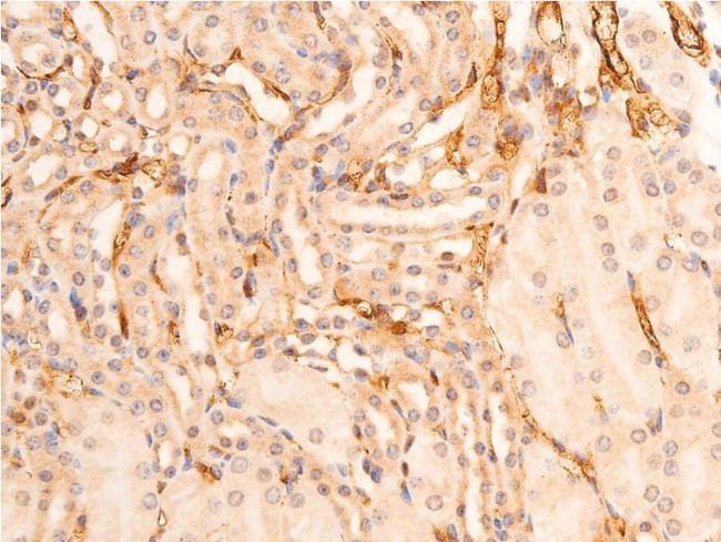 Phospho-Chk1 (Ser280) Antibody in Immunohistochemistry (Paraffin) (IHC (P))