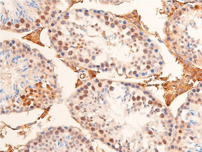 Phospho-Chk1 (Ser280) Antibody in Immunohistochemistry (Paraffin) (IHC (P))