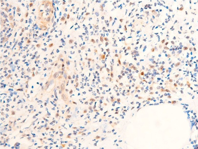 Phospho-Chk1 (Ser280) Antibody in Immunohistochemistry (Paraffin) (IHC (P))