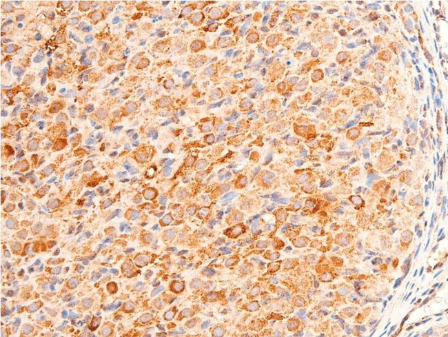 Phospho-Chk1 (Ser280) Antibody in Immunohistochemistry (Paraffin) (IHC (P))