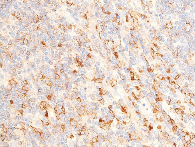 Phospho-Chk1 (Ser317) Antibody in Immunohistochemistry (Paraffin) (IHC (P))