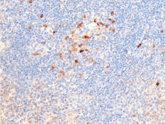 Phospho-Chk1 (Ser317) Antibody in Immunohistochemistry (Paraffin) (IHC (P))