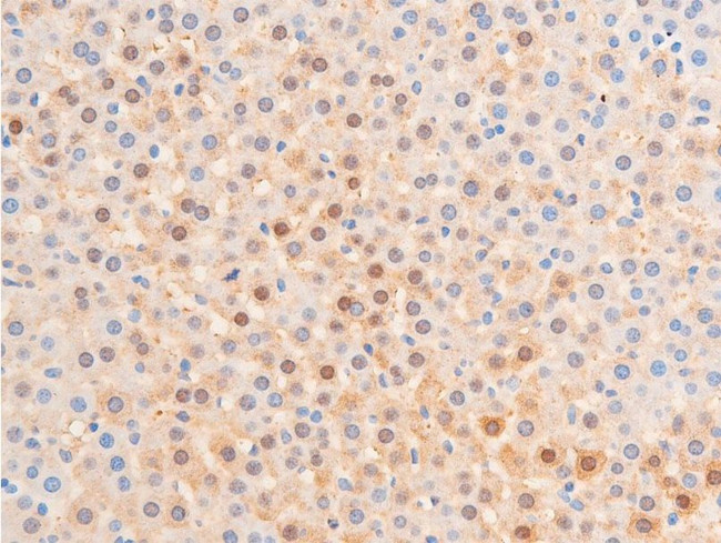 Phospho-Chk1 (Ser317) Antibody in Immunohistochemistry (Paraffin) (IHC (P))