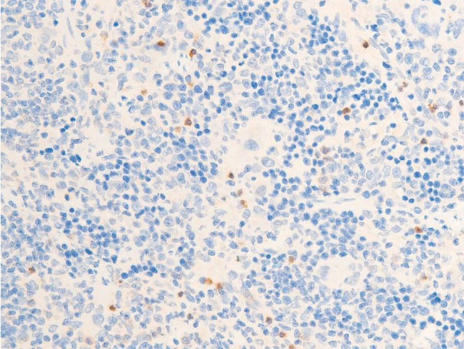 Phospho-Chk1 (Ser317) Antibody in Immunohistochemistry (Paraffin) (IHC (P))