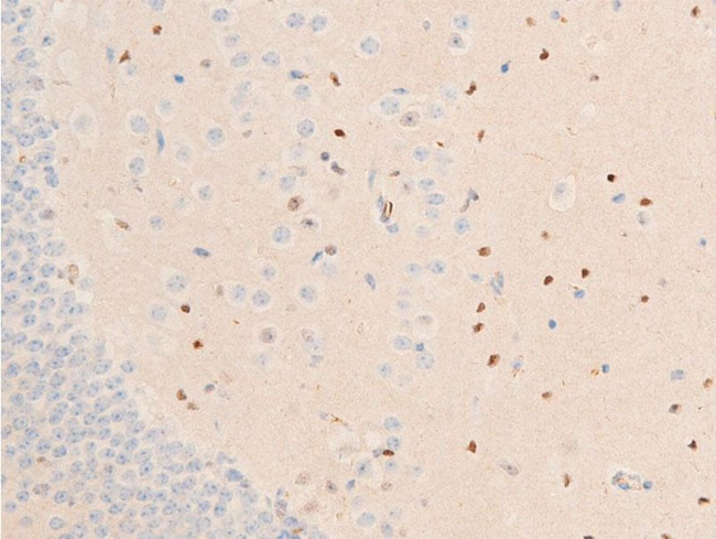 Phospho-Chk1 (Ser317) Antibody in Immunohistochemistry (Paraffin) (IHC (P))